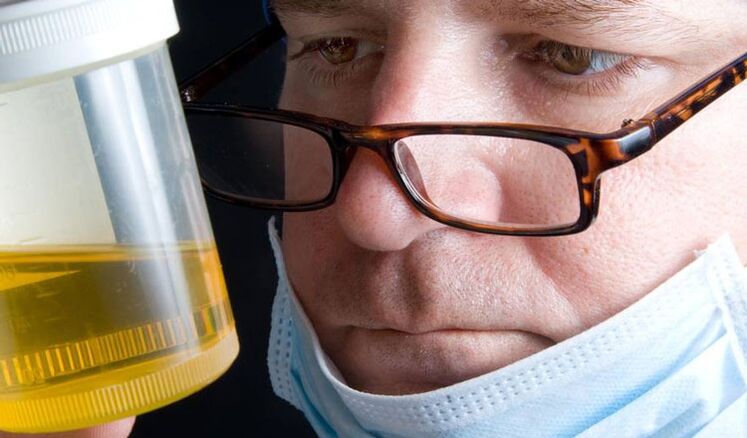 Diagnosi di prostatite