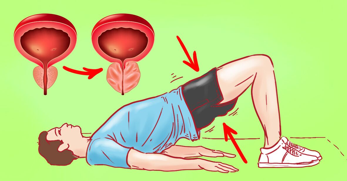 Esercizi di ginnastica per la prostatite